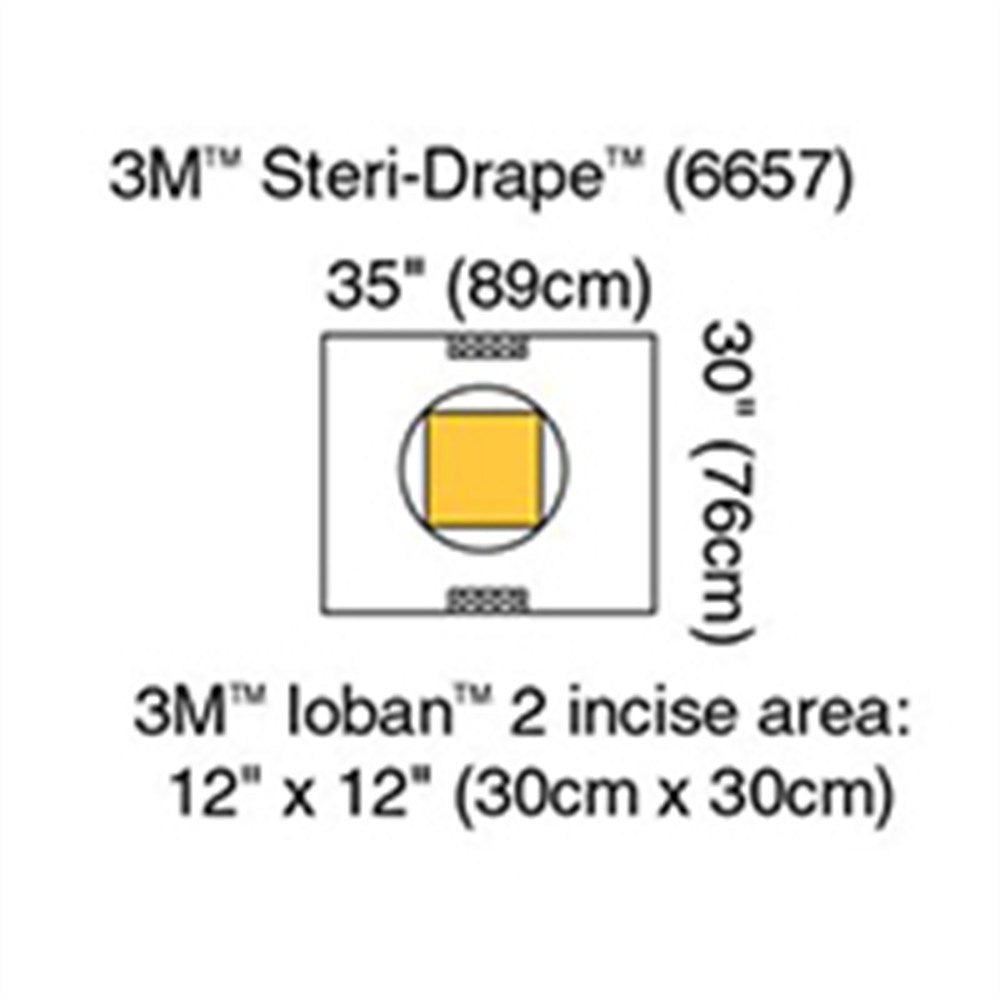 3M STERI-DRAPE Cesarean-Section Pouch with Loban 2 Incise Film, 35" x 30", 10/box, 4 box/case. MPN: 6657