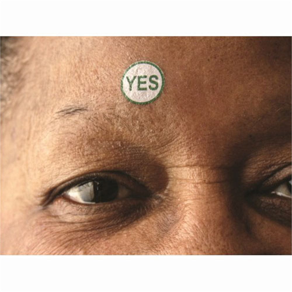 TAT Marker- Small, 1/2" Diameter, Green- YES Mark. MPN: TYS-400 - Image 4