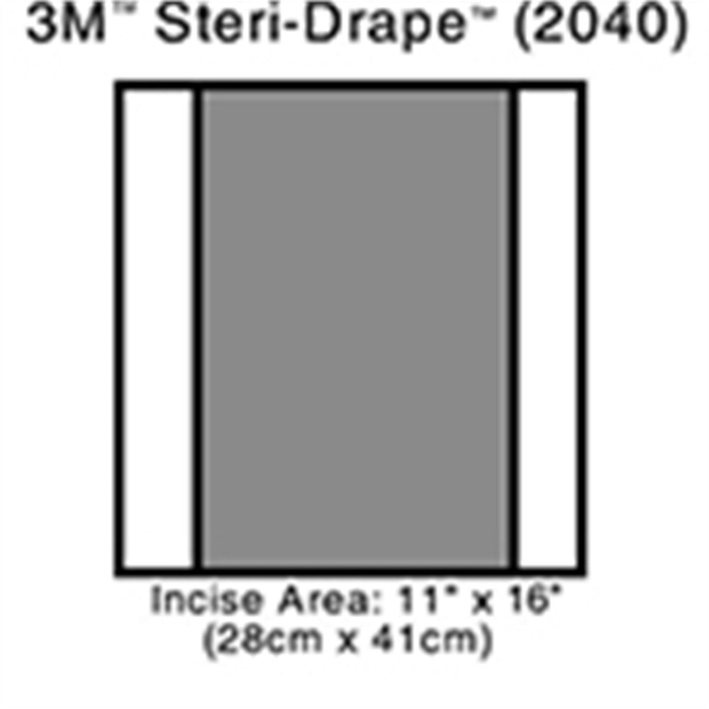 3M STERI-DRAPE 2 Incise Drape, Overall 14" x 16", Incise 11" x 16", 10/box, 4 box/case. MPN: 2040