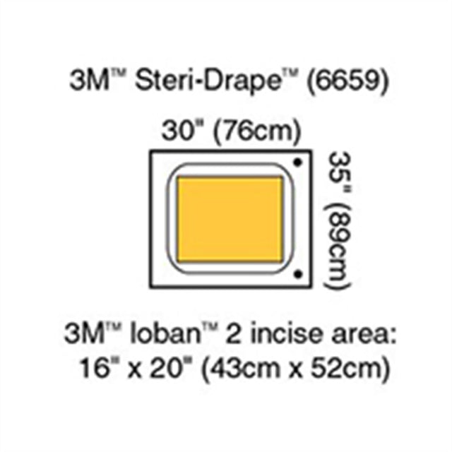 3M STERI-DRAPE Surgical Drape Pouch, 30" x 35", Incise 16" x 20", 5/box, 4 box/case. MPN: 6659