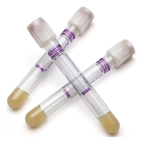 BD PPT VACUTAINER Plastic Molecular Diagnostics Tube, 13 x 100 mm x 5.0 mL, 100/pack, 10 pack/case. MPN: 362788