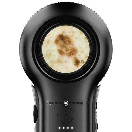 DermLite V Dermatoscope with PigmentBoost, DermLite 5. MPN: DL5 - Image 3