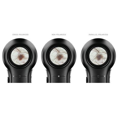DermLite V Dermatoscope with PigmentBoost, DermLite 5. MPN: DL5 - Image 9