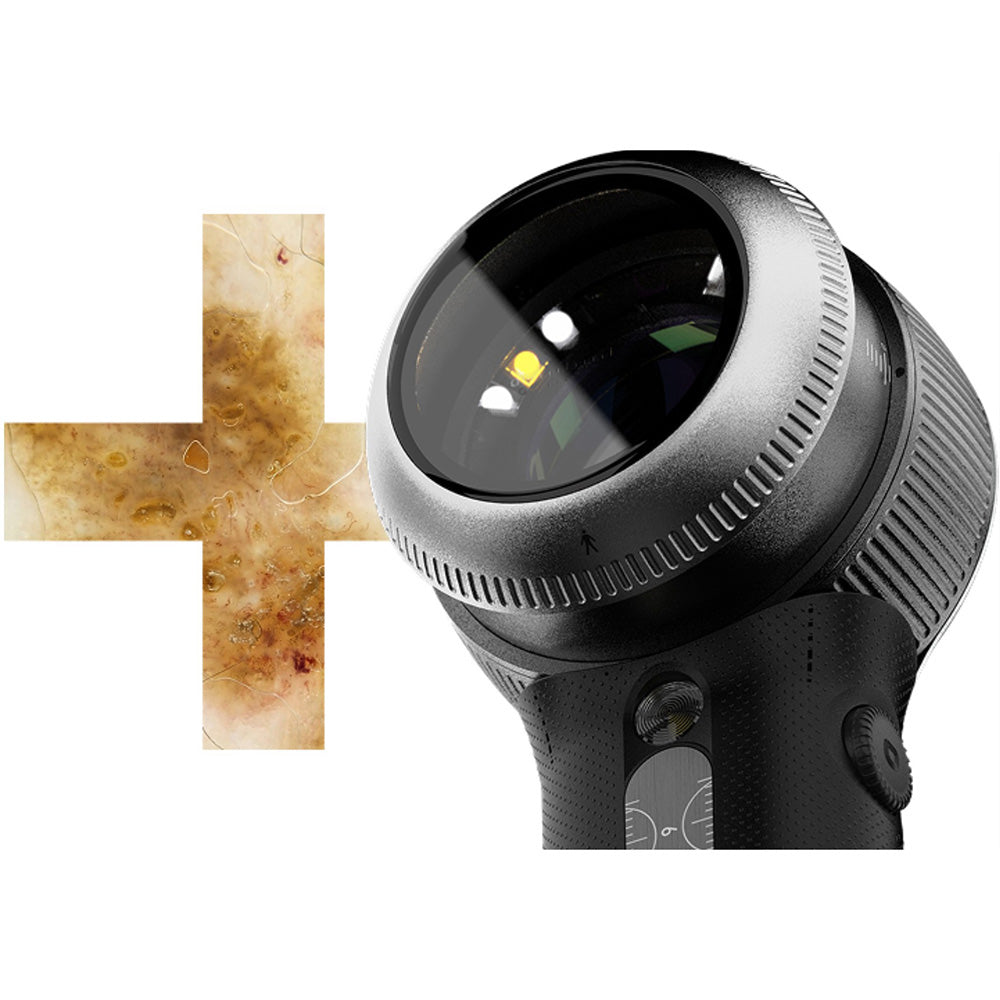 DermLite V PLUS Dermatoscope with PigmentBoost, DermLite 5 PLUS. MPN: DL5PLUS - Image 2