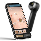 DermLite V PLUS Dermatoscope with PigmentBoost, DermLite 5 PLUS. MPN: DL5PLUS - Image 5