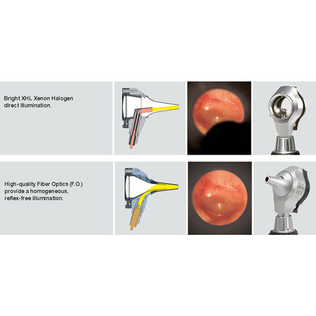 HEINE mini 3000 LED Fiber Optic Otoscope with mini 3000 battery Handle and 10 AllSpec Disposable Ear Tips. MPN: D-008.70.110 - Image 5