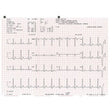 Schiller Z-fold Recording Paper for AT-10 Plus (10 packs). MPN: 2.157040C