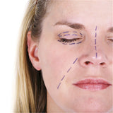 Surgical Marker, Sterile BlephMarker, 100 per case. MPN: 1424SR-100 - Image 2