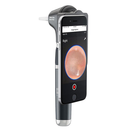 Welch Allyn MacroView Plus LED Otoscope for iExaminer. MPN: 238-3 - Image 3