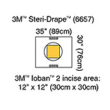 3M STERI-DRAPE Cesarean-Section Pouch with Loban 2 Incise Film, 35" x 30", 10/box, 4 box/case. MFID: 6657 (USA ONLY)