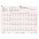 Schiller Z-fold Recording Paper for AT-10 Plus (10 packs). MFID: 2.157040C